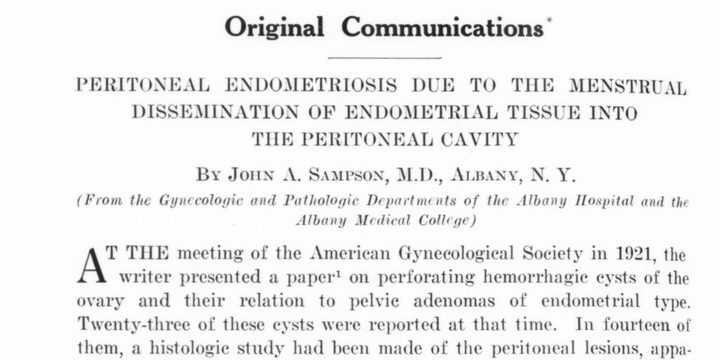 The first page of a 1927 journal article, its title Peritoneal Endometriosis in capitals above the author's name, John A. Sampson.